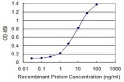 EBAG9/RCAS1 Antibody (4A10), Novus Biologicals 0.1 mg | Buy Online | Novus Biologicals | Fisher Scientific