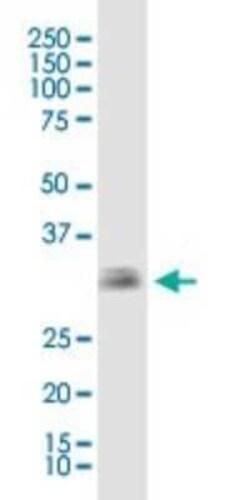 EBAG9/RCAS1 Antibody (4A10), Novus Biologicals 0.1 mg | Buy Online | Novus Biologicals | Fisher Scientific