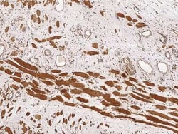 EBAG9/RCAS1 Antibody, Novus Biologicals 100 &mu;g; Unconjugated:Antibodies,