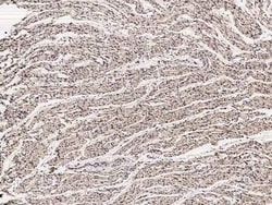 EBAG9/RCAS1 Antibody, Novus Biologicals 100 &mu;g; Unconjugated:Antibodies,
