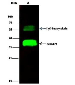 EBAG9/RCAS1 Antibody, Novus Biologicals 100 &mu;g; Unconjugated:Antibodies,