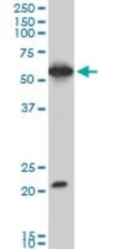 EBF-3 Antibody (1G3), Novus Biologicals 0.1 mg | Buy Online | Novus Biologicals | Fisher Scientific