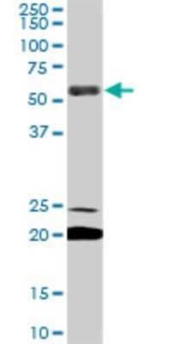 EBF-3 Antibody (8D6), Novus Biologicals 0.1 mg | Buy Online | Novus Biologicals | Fisher Scientific