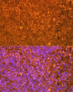 EBI3 Rabbit anti-Human, Mouse, Rat, Clone: 9J1H4, Novus Biologicals 20