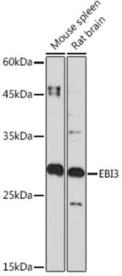 EBI3 Rabbit anti-Human, Mouse, Rat, Clone: 9J1H4, Novus Biologicals 20