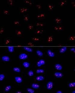 EBNA1BP2 Antibody - BSA Free, Novus Biologicals 0.02 mL, Unconjugated:Antibodies,