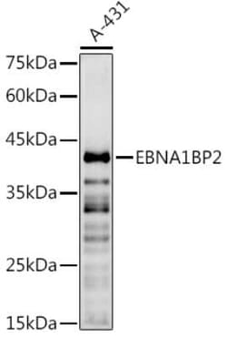 EBNA1BP2 Antibody - BSA Free, Novus Biologicals 0.02 mL, Unconjugated:Antibodies,