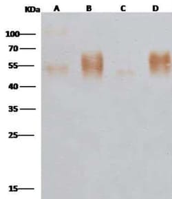 EBOV GP Antibody, Novus Biologicals:Antibodies:Primary Antibodies