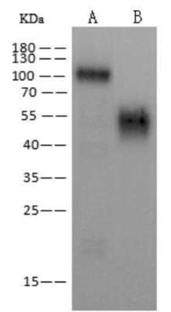 EBOV GP Antibody, Novus Biologicals 100 &mu;g; Unconjugated:Antibodies,