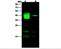 EBOV GP1 Antibody, Novus Biologicals 100 &mu;g; Unconjugated:Antibodies,