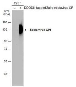 EBOV GP1 Antibody, Novus Biologicals 100 &mu;g | Buy Online | Novus Biologicals | Fisher Scientific