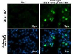 EBOV GP2-delta Antibody, Novus Biologicals 100 &mu;g | Buy Online | Novus Biologicals | Fisher Scientific