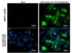 EBOV VP30 protein Antibody, Novus Biologicals 100 &mu;g; Unconjugated:Antibodies,