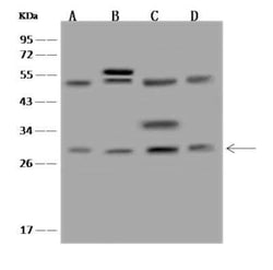EBP Antibody, Novus Biologicals 100 &mu;g; Unconjugated:Antibodies, Polyclonal