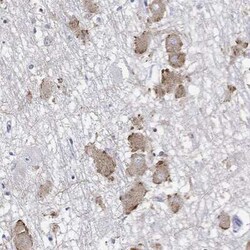 ECEL1 Rabbit anti-Human, Polyclonal, Novus Biologicals:Antibodies:Primary