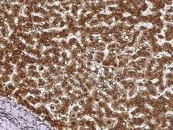 ECH1 Antibody, Novus Biologicals:Antibodies:Primary Antibodies