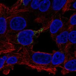 ECHDC1 Antibody, Novus Biologicals 25ul; Unconjugated:Antibodies, Polyclonal