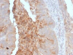 ECM-1/Secretory Component P85 Antibody (ECM1/792), Novus Biologicals 0.02mg;