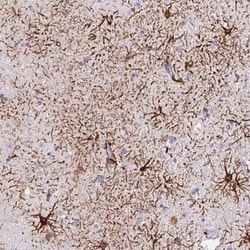ECM29 Antibody, Novus Biologicals:Antibodies:Primary Antibodies
