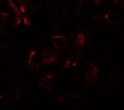 EDA-A1/Ectodysplasin A1 Antibody - BSA Free, Novus Biologicals 0.1 mg;