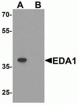 EDA-A1/Ectodysplasin A1 Antibody - BSA Free, Novus Biologicals 0.1 mg;