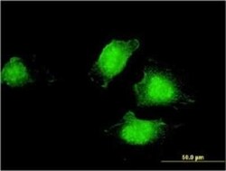 EDC4 Antibody (2E2), Novus Biologicals 0.1 mg | Buy Online | Novus Biologicals | Fisher Scientific