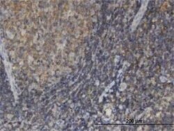 EDC4 Antibody (2E2), Novus Biologicals 0.1 mg | Buy Online | Novus Biologicals | Fisher Scientific