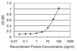 EDC4 Antibody (2E2), Novus Biologicals 0.1 mg | Buy Online | Novus Biologicals | Fisher Scientific