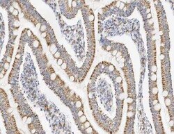 EDEM2 Antibody, Novus Biologicals 100 &mu;g; Unconjugated:Antibodies, Polyclonal