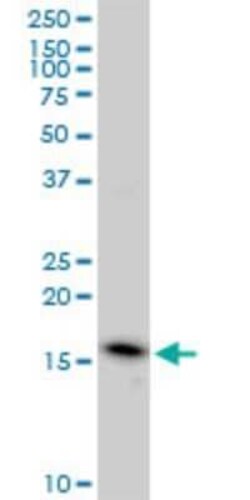 Novus Biologicals EDF1 Antibody (3E6), Novus Biologicals 0.1 mg | Buy Online | Novus Biologicals&trade; | Fisher Scientific