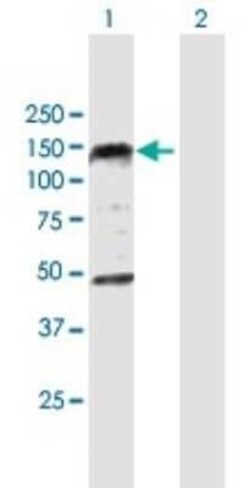 EDR1/PHC1 Antibody, Novus Biologicals 0.05 mg | Buy Online | Novus Biologicals | Fisher Scientific