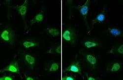EED Antibody (GT885), Novus Biologicals 100 &mu;g; Unconjugated:Antibodies,