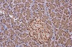 EED Antibody (GT885), Novus Biologicals 100 &mu;g; Unconjugated:Antibodies,
