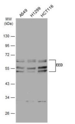 EED Antibody (GT885), Novus Biologicals 100 &mu;g; Unconjugated:Antibodies,