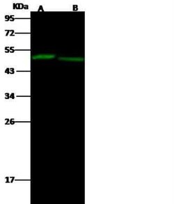 EED Antibody, Novus Biologicals 100 &mu;g, Unconjugated:Antibodies, Polyclonal