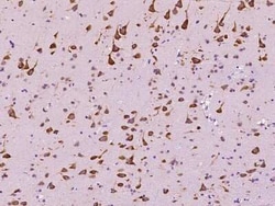 EEF1A2 Antibody, Novus Biologicals 50 &mu;g, Unconjugated:Antibodies, Polyclonal
