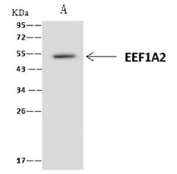 EEF1A2 Antibody, Novus Biologicals 50 &mu;g, Unconjugated:Antibodies, Polyclonal