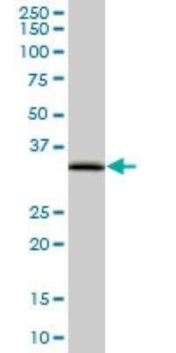 EEF1D Antibody (4B12), Novus Biologicals 0.1 mg | Buy Online | Novus Biologicals | Fisher Scientific