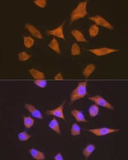 EEF1G Rabbit anti-Human, Mouse, Rat, Clone: 2E1O7, Novus Biologicals 20 &mu;g | Buy Online | Novus Biologicals | Fisher Scientific