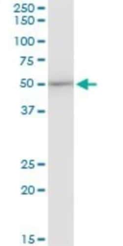 EEF1G Antibody (3F11-1A10), Novus Biologicals 0.1 mg | Buy Online | Novus Biologicals | Fisher Scientific