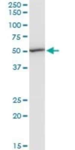 EEF1G Antibody (3F11-1A10), Novus Biologicals 0.1 mg | Buy Online | Novus Biologicals | Fisher Scientific