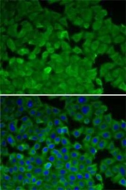 EEF2K Antibody - BSA Free, Novus Biologicals:Antibodies:Primary Antibodies
