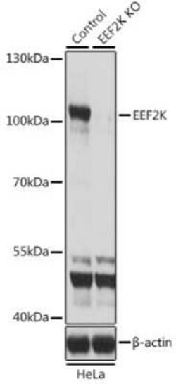 EEF2K Antibody - BSA Free, Novus Biologicals:Antibodies:Primary Antibodies