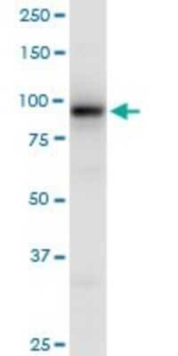 EEF2K Antibody, Novus Biologicals 0.05 mg | Buy Online | Novus Biologicals | Fisher Scientific