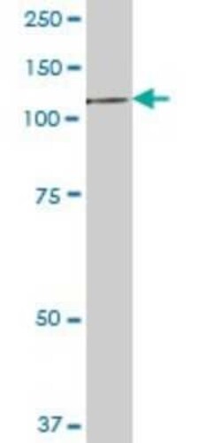 EEF2K Antibody, Novus Biologicals 0.05 mg | Buy Online | Novus Biologicals | Fisher Scientific