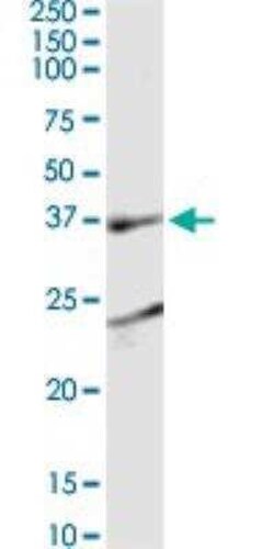 EEN Antibody (1B8), Novus Biologicals 0.1 mg | Buy Online | Novus Biologicals | Fisher Scientific