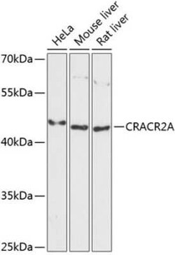 EFCAB4B Antibody - Azide and BSA Free, Novus Biologicals:Antibodies:Primary
