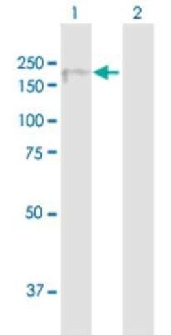 EFCAB6 Antibody, Novus Biologicals 0.05 mg | Buy Online | Novus Biologicals | Fisher Scientific