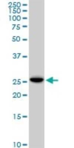 EFHD1 Antibody (1H7), Novus Biologicals 0.1 mg | Buy Online | Novus Biologicals | Fisher Scientific