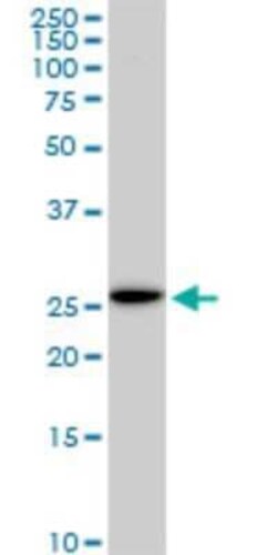 EFHD1 Antibody (1H7), Novus Biologicals 0.1 mg | Buy Online | Novus Biologicals | Fisher Scientific